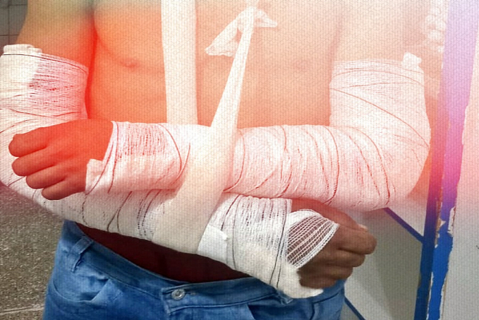 Casal é preso suspeito de torturar e quebrar braços de homem em Porto Velho - News Rondônia
