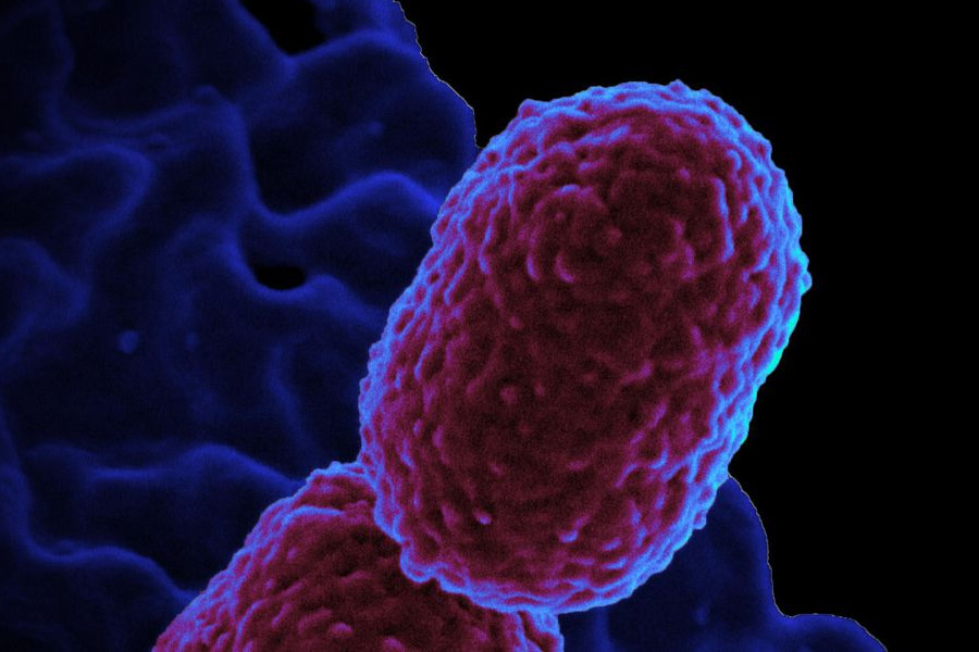 Europa tem mais de 35 mil mortes anuais por resistência antimicrobiana - News Rondônia