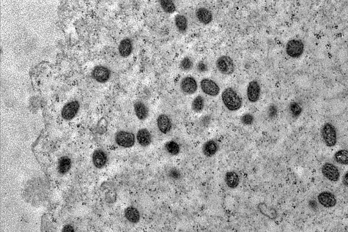 Mpox ainda é problema de saúde pública, dizem especialistas da Fiocruz - News Rondônia