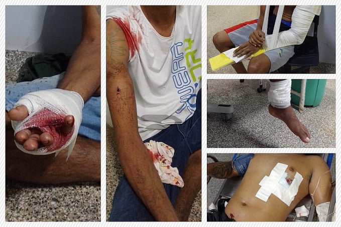 Noite de Violência em Porto Velho: Seis feridos em série de ataques na Zona Leste - News Rondônia