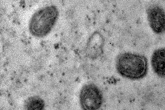 Fiocruz registra imagens de replicação do vírus monkeypox em célula - News Rondônia