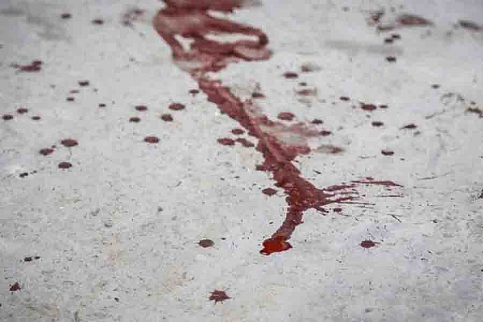 Jovem é esfaqueada ao tentar separar briga em distrito - News Rondônia