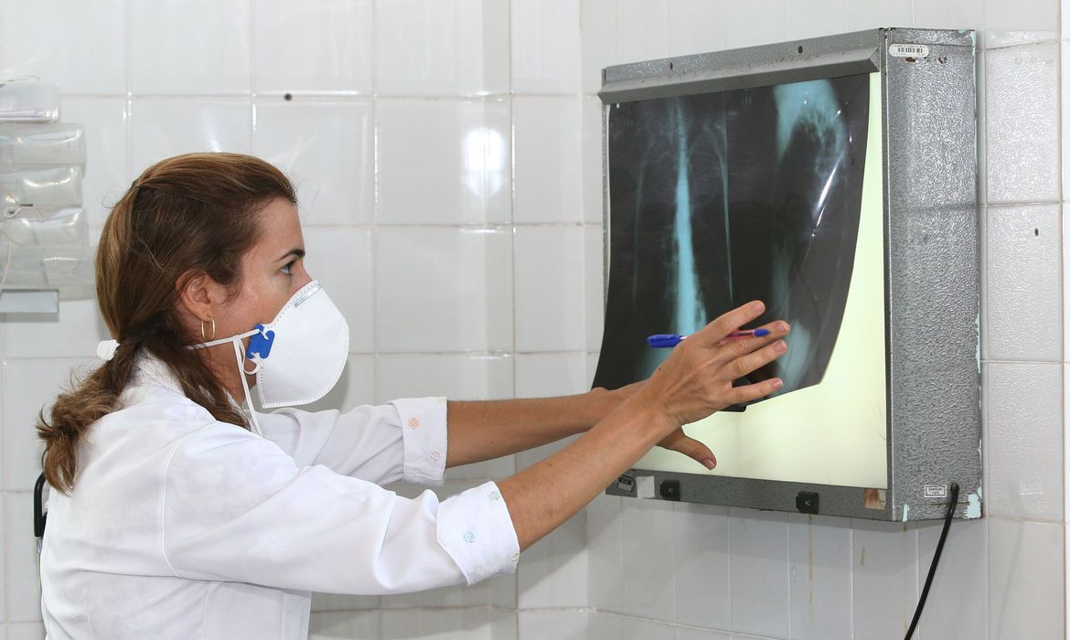 Governo cria comitê para reduzir casos de tuberculose até 2030