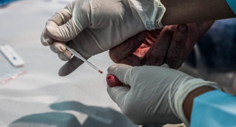 Parceria entre Agevisa e Semusa leva ações de combate às hepatites virais à Unidade de Saúde em Porto Velho