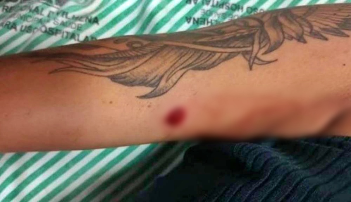 CINCO TIROS: Garota de 16 anos sofre tentativa de homicídio - News Rondônia