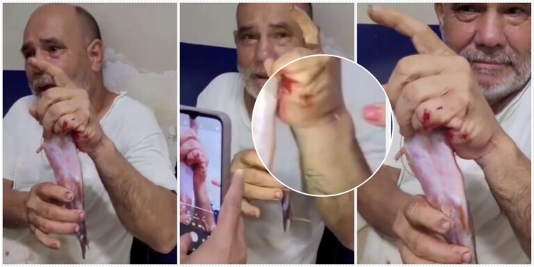 Pescador é atingido por peixe bagre e tem mão perfurada em Jaru - News Rondônia