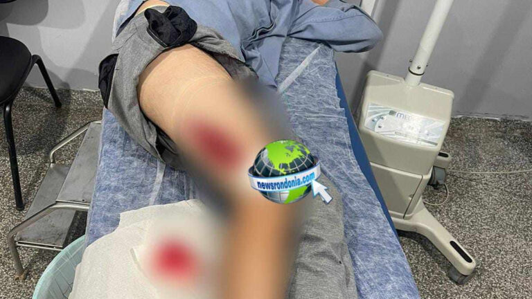 Adolescente é baleado durante ataque no Cristal da Calama - News Rondônia