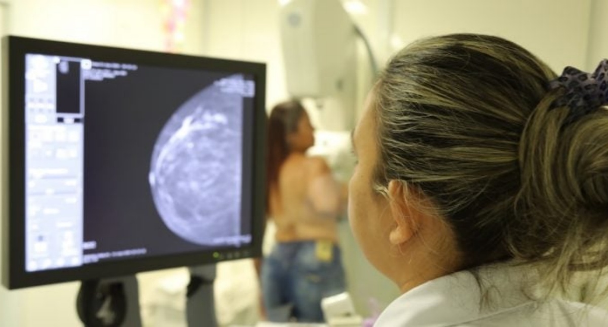 Carreta do Hospital do Amor: Prefeitura de Jaru realiza agendamentos para exames de mamografia, preventivo e câncer de pele