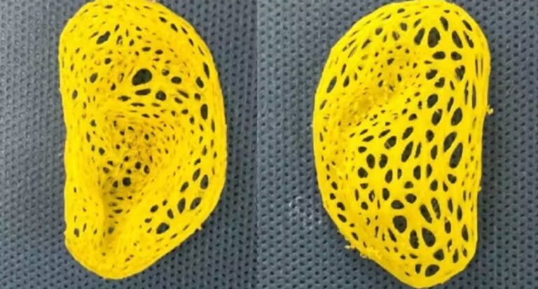 Pesquisadores fazem réplica de orelha humana em 3D; opção ao enxerto