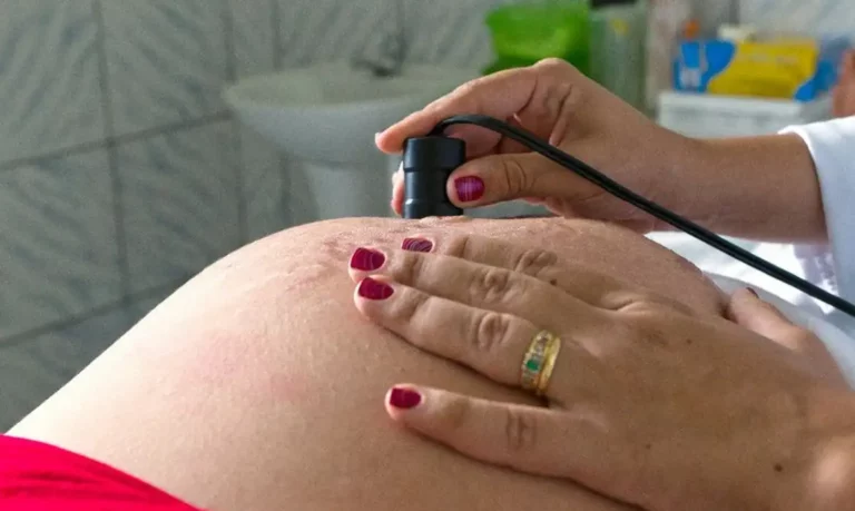 CFM tem 72 horas para explicar proibição de procedimento pré-aborto