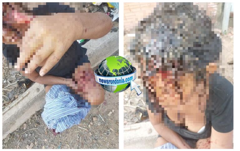 Mulher é espancada a pauladas após pedir para marido não usar drogas em casa