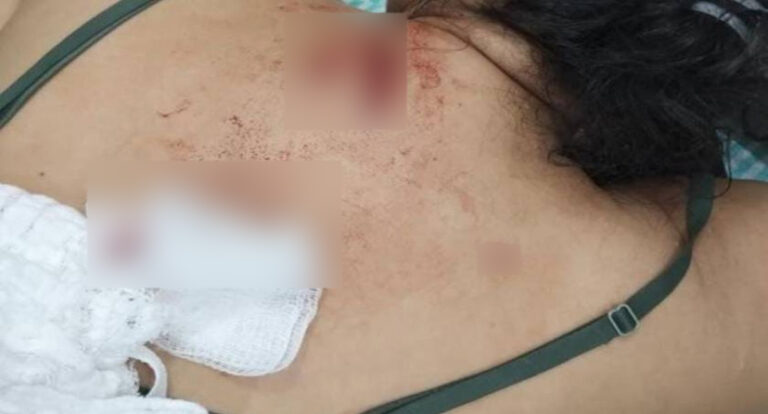 Briga termina com mulher ferida pela própria filha adolescente, em Vilhena