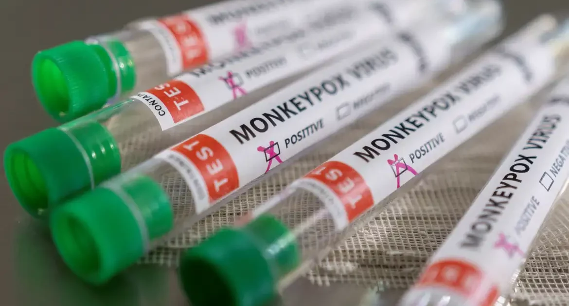 Suécia registra primeiro caso de mpox fora da África