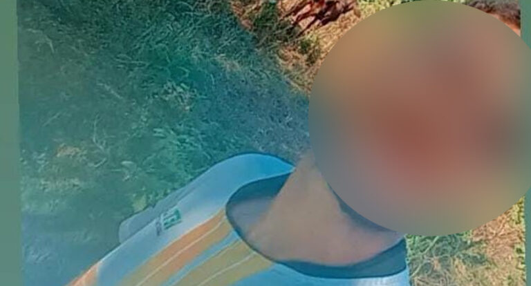 Jovem perde a vida em trágico acidente na zona rural de São Miguel do Guaporé