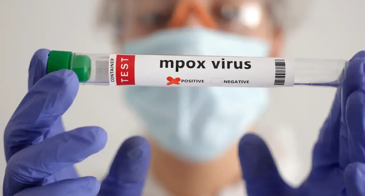 OMS: África soma quase 30 mil casos suspeitos de mpox este ano