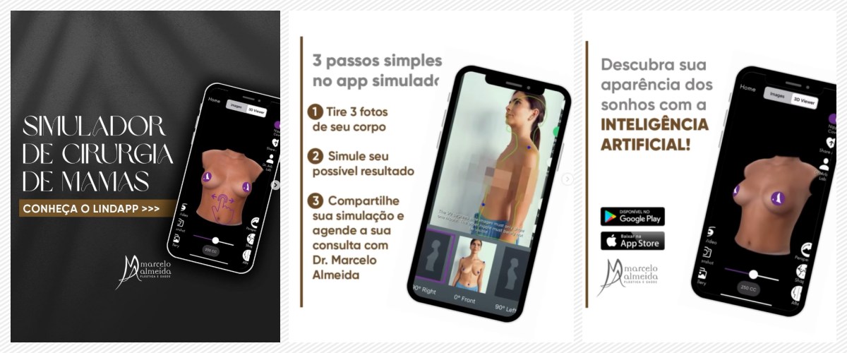 Transforme seu visual com o simulador de cirurgia plástica Lindapp - News Rondônia