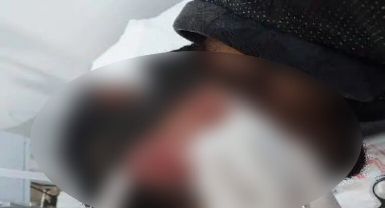 Homem é esfaqueado na cabeça e levado ao hospital em Presidente Médici