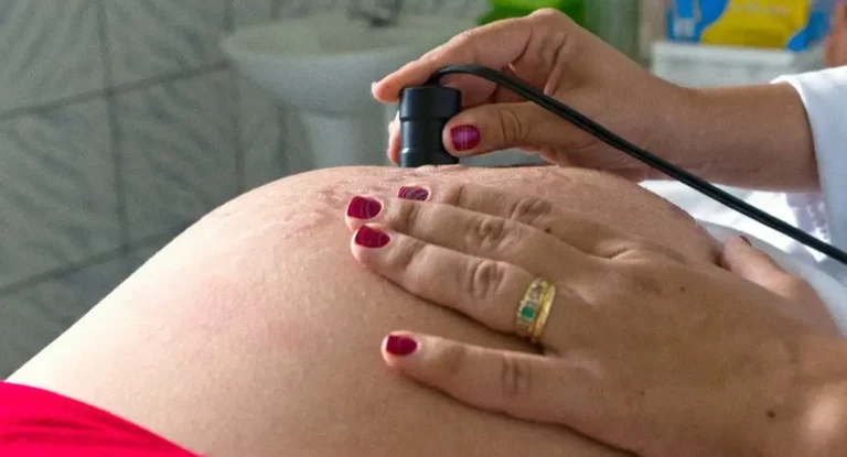 Saúde recomenda cálcio para todas as gestantes para prevenir eclâmpsia