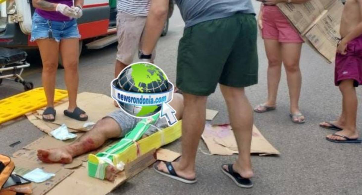 Motociclista sofre fratura exposta em colisão de frente com carro - News Rondônia