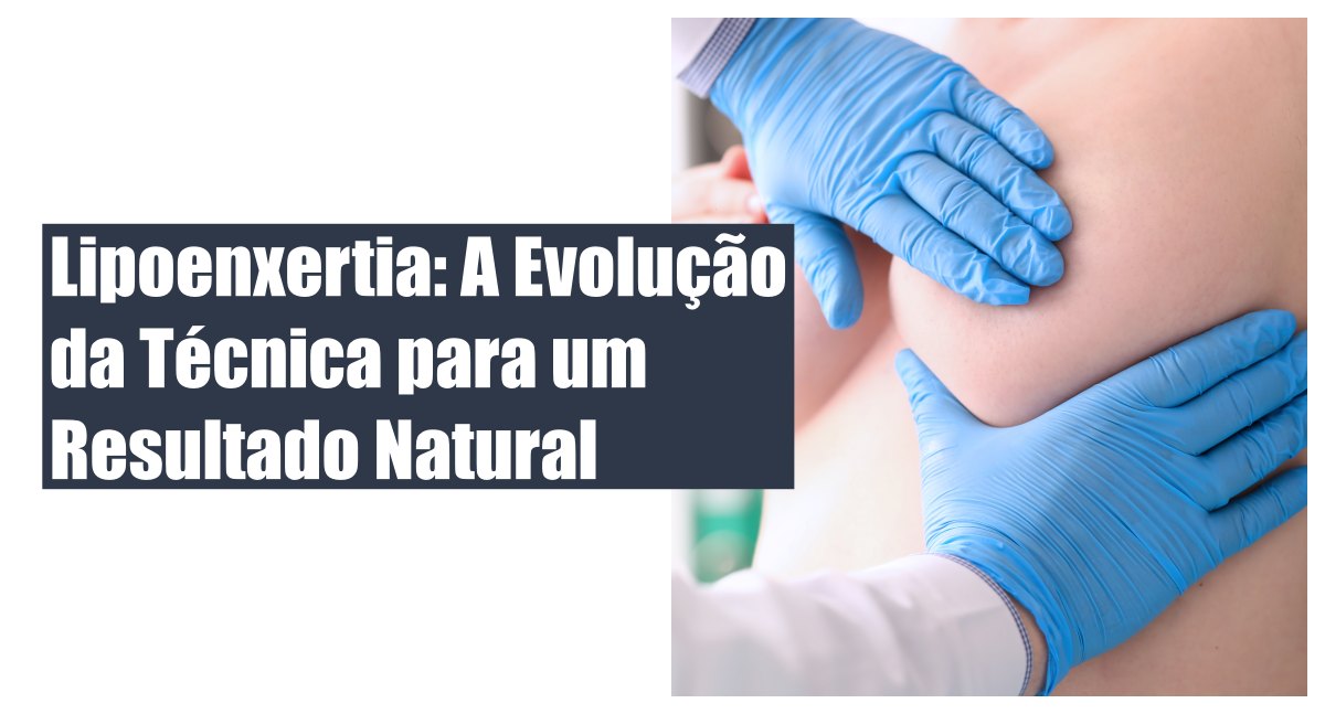 Explante Mamário: O que é, benefícios e a técnica de mama híbrida - News Rondônia