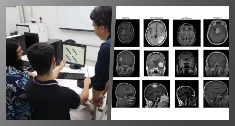 IA desenvolvida por brasileiros pode ajudar a diagnosticar tumores cerebrais - News Rondônia