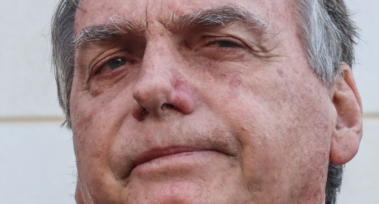 Bolsonaro apresenta piora clínica e segue na UTI após cirurgia abdominal, diz hospital