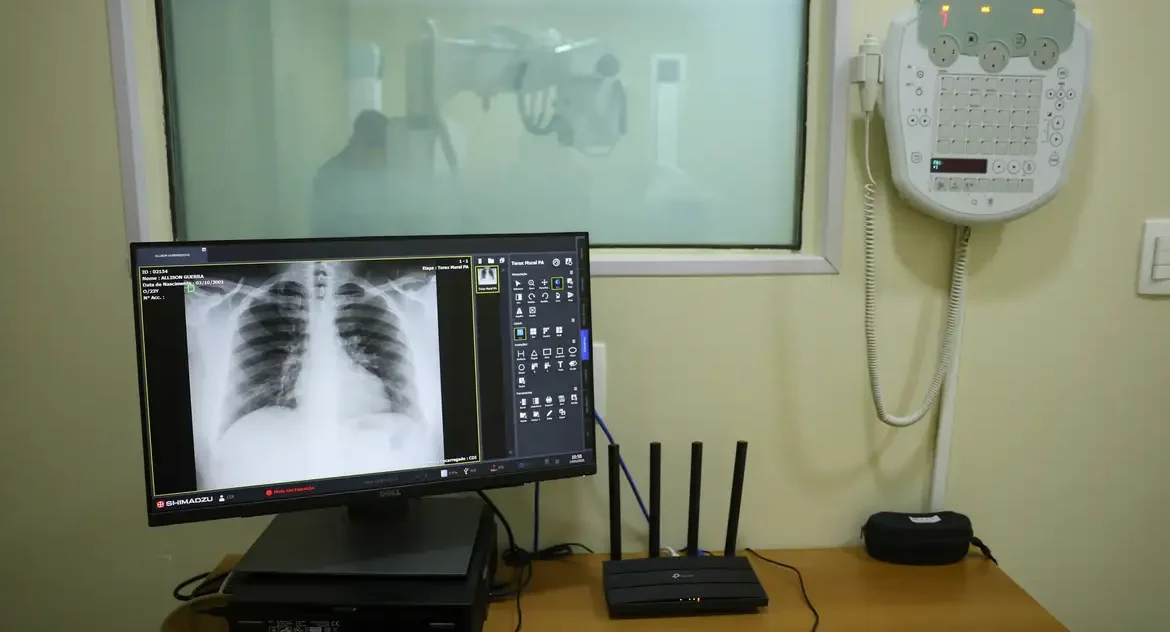 Alerta para alta de casos de Síndrome Respiratória Aguda Grave e hospitalizações por gripe em 13 estados e no DF, aponta Fiocruz