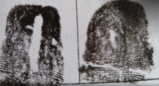 Polícia Civil usa técnica forense para identificar corpo em decomposição em Porto Velho