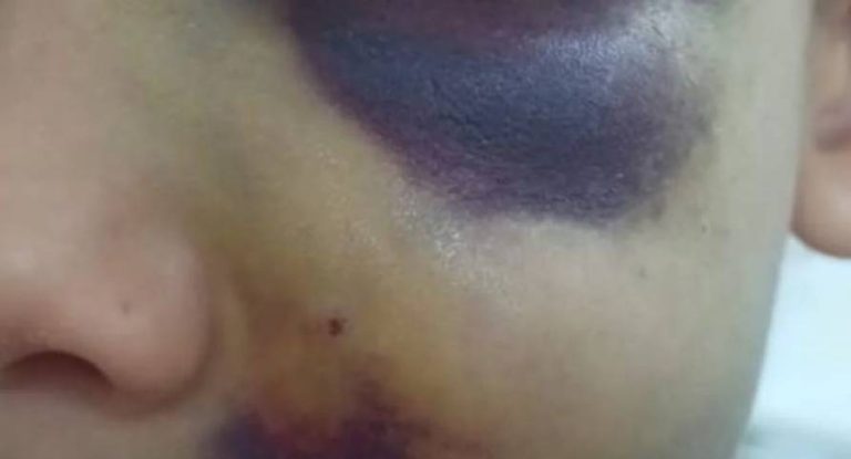 Criança de 4 anos com hematoma é encontrada sozinha em rua movimentada