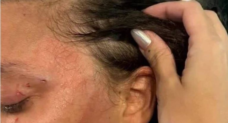 Homem agride companheira após discussão por ciúmes; casal é levado à polícia