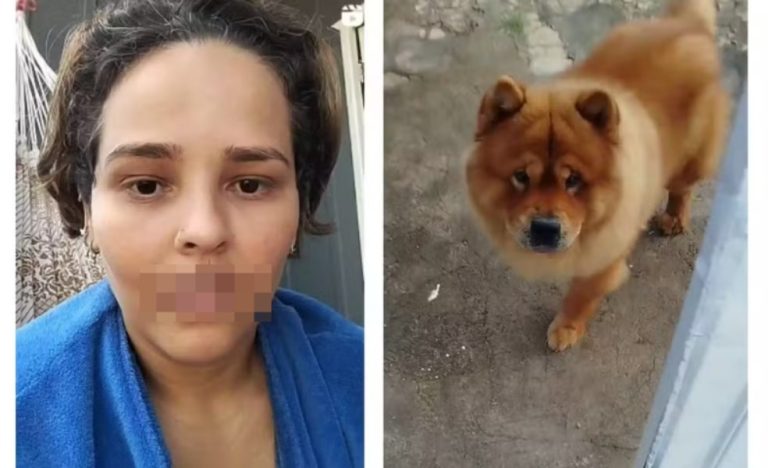 Após ataque de cão, mulher enfrenta trauma e linchamento virtual - News Rondônia
