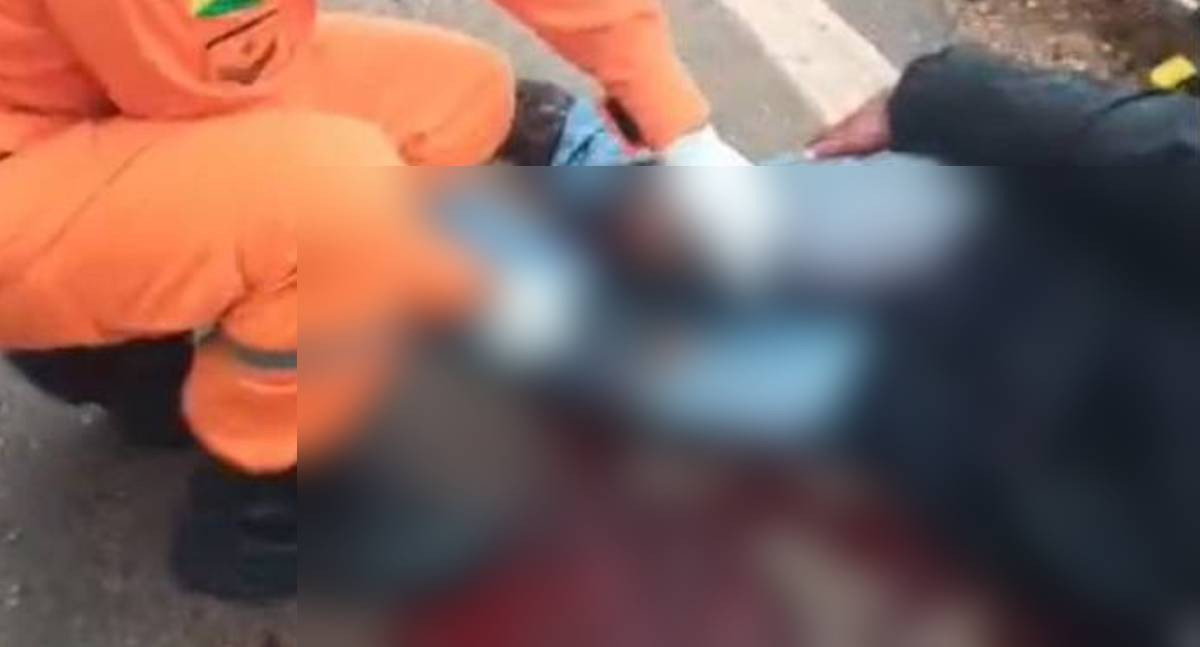 Acidente grave deixa motociclista com fraturas expostas
