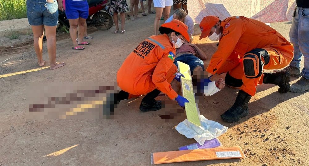 Motociclista sofre fratura exposta após colisão entre motos