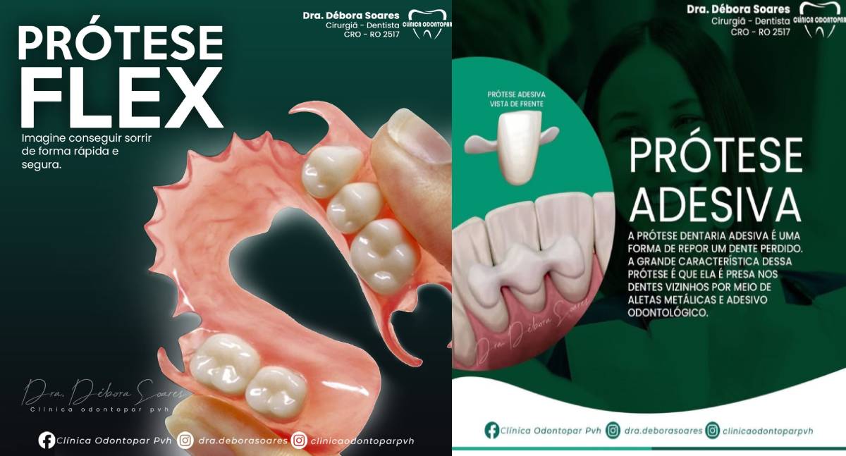 Agenda News: Sorriso renovado com alternativas ao implante dentário que transformam vidas na Clínica Odontopar