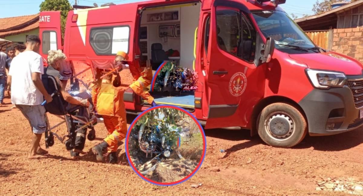 Criança fratura perna em acidente com motos em Rolim de Moura