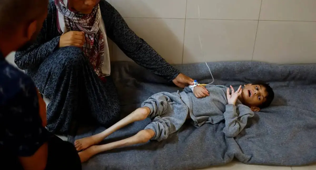 Gaza enfrenta crise de desnutrição infantil com escassez iminente de suprimentos essenciais