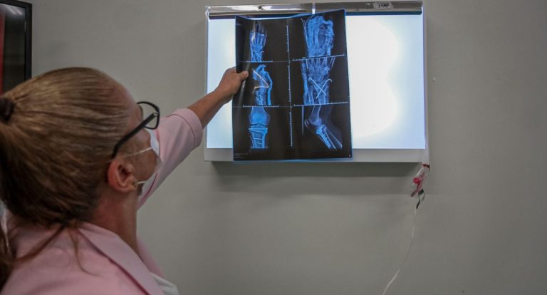 Redução de acidentes de trânsito em Rondônia diminui atendimentos de saúde em até 17%