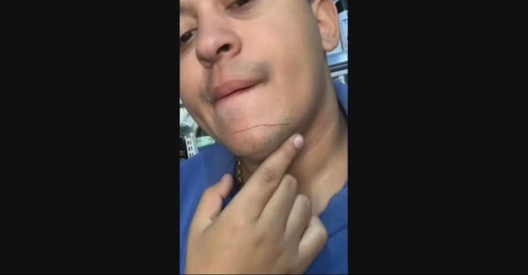 Motociclista é atingido por linha chilena e evita ferimento grave no pescoço: “Consegui puxar a tempo” - News Rondônia