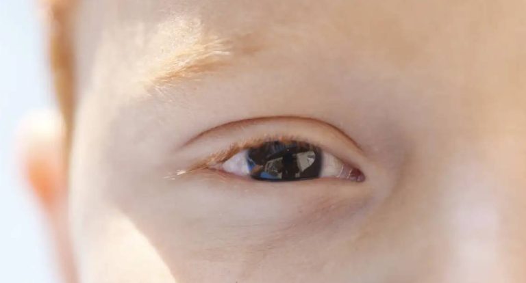 Cartilha de saúde ocular infantil orienta pais e educadores