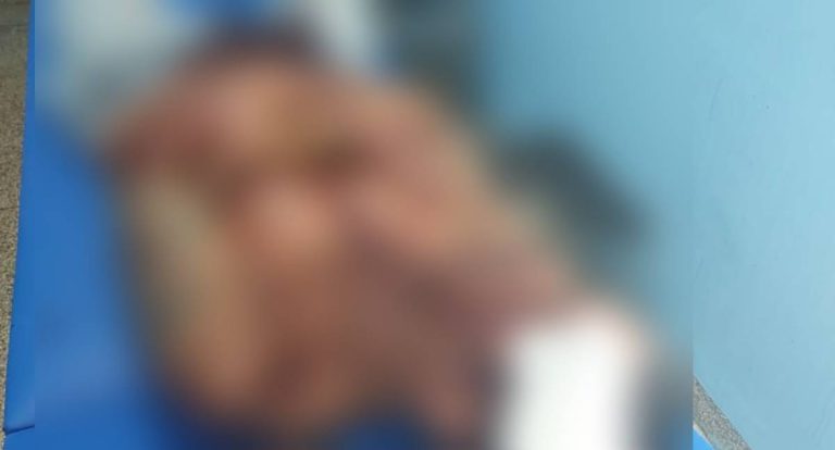 Homem é atacado com facão em Candeias do Jamari