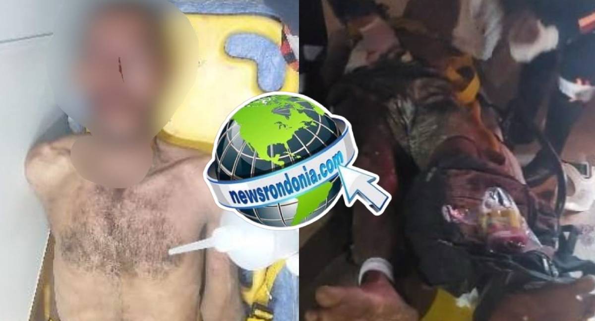 Homem é tem rosto desfigurado após ser espancado por trio na zona leste