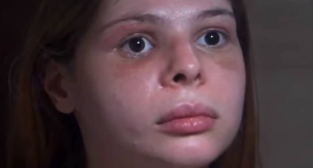 Médica agredida por fisiculturista perde parte da visão e tem rosto desfigurado na zona Sul