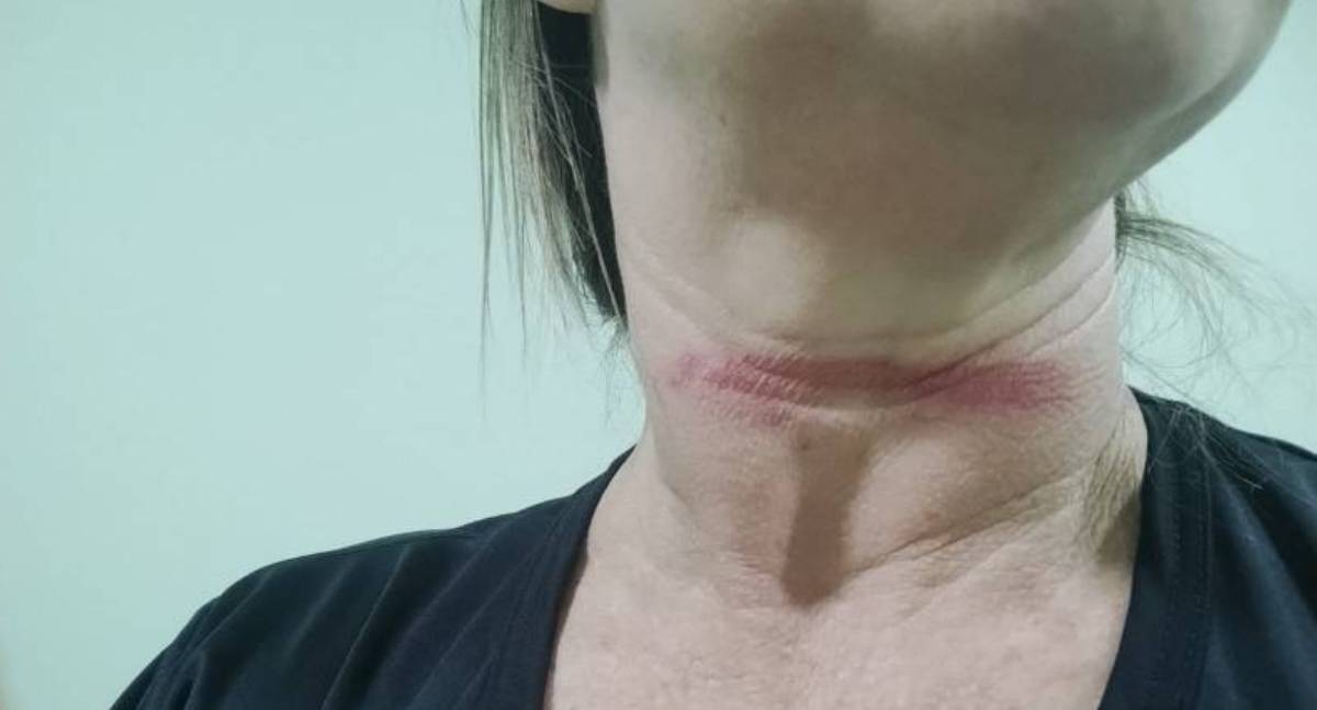 Motociclista se machuca com fio de internet que caiu em rua de Vilhena