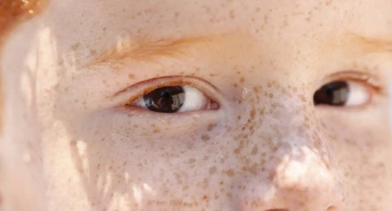 Reflexo branco nos olhos entenda a condição que assusta pais