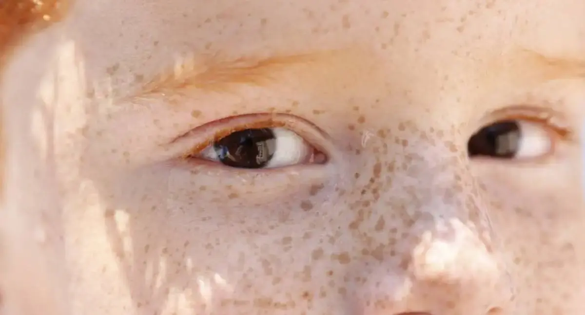 Reflexo branco nos olhos entenda a condição que assusta pais