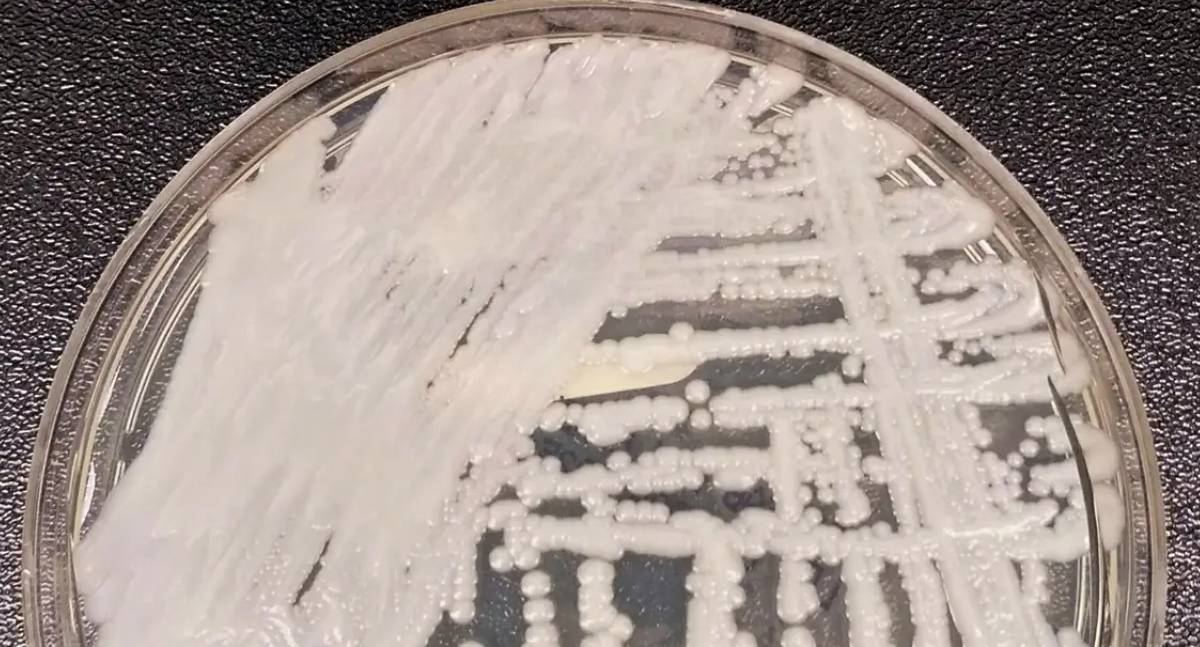 Europa alerta sobre fungo C. auris em hospitais
