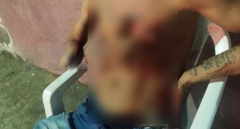 Jovem sofre três facadas em tentativa de homicídio em RO