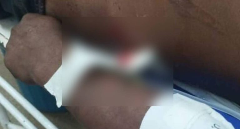 Morte de rondoniense por indígenas no Amazonas será investigada pela PF