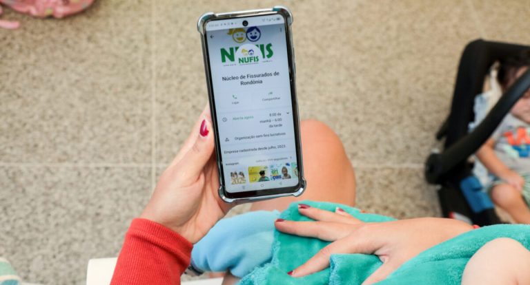 Núcleo de Fissurados de Rondônia já realizou mais de 24 mil consultas e 317 cirurgias desde 2018
