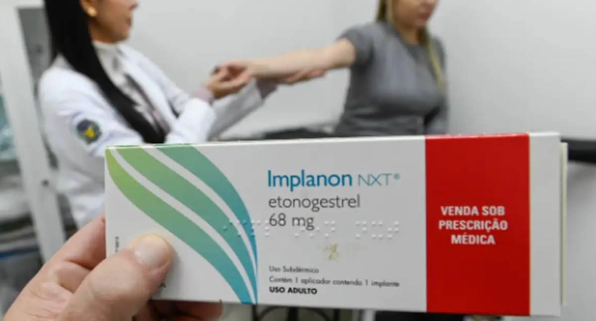 Planos de saúde oferecem Implanon de graça